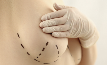 cirugia mamaria andorra